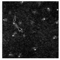 [Nanogold-Fab' STEM micrograph] (33k)