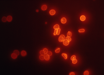 Blood Cells Labeled