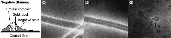 [Negative Staining - Principle and Examples (41k)]