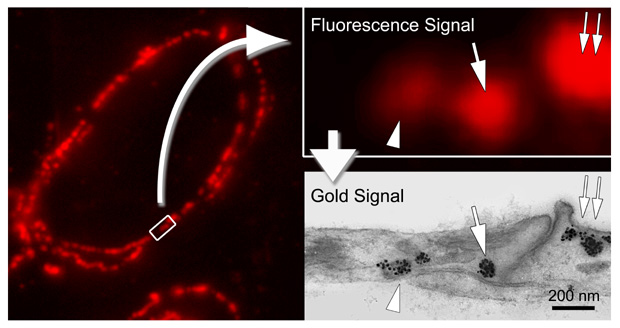[Alexa Fluor 594 FluoroNanogold: correlative fluorescence and TEM labeling (63k)]