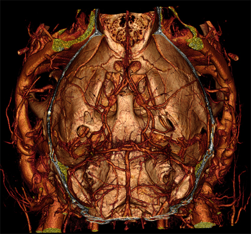 MicroCT of circulatory system and kidneys of live mouse after IV injection of VivoVist