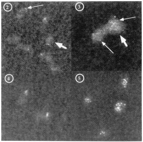 [Figures 2-5: Micrographs] (131k)