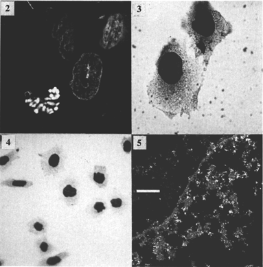 [Figures 2-5: Micrographs] (100k)