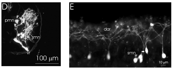 [Figure 1 D and E] (37k)