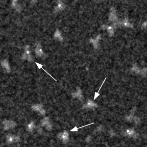 STEM Micrograph of Nanogold-IgG conjugate (36k)