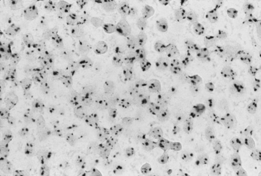 CARD-Nanogold detection of Sinlge-Copy HPV-16 in SiHa cells (59k)