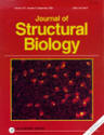 Ni-NTA-Nanogold labels polyhistidine His-tagged proteins: STEM micrography by James F. Hainfeld, on the cover of the Journal of Structural Biology