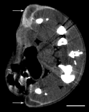 MicroCT section of mouse with two subcutaneous tumors (one one each leg, arrows) showing AuroVist™-15 nm uptake 20 hours after intraveneous injection.   Bar = 5 mm.</p>       </p>            </p>