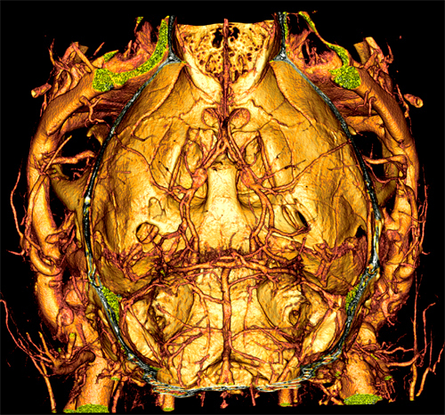 MicroCT of circulatory system and kidneys of live mouse after IV injection of VivoVist