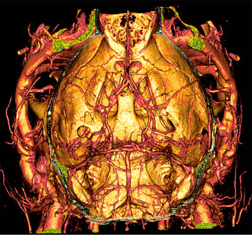 MicroCT of circulatory system and kidneys of live mouse after IV injection of VivoVist