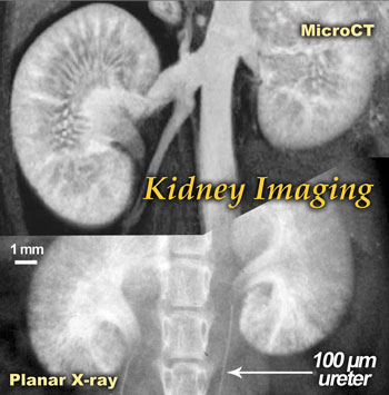 Live mouse 1 hour after injection with AuroVist X-ray contrast agent, showing kidney contrast and fine structure (bar = 1 mm).