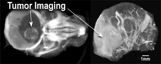 MicroCT of brain of live mouse after IV injection of AuroVist-15 nm. 
Tumor stands out (white density) due to penetration of AuroVist-15 nm
through the compromised blood-brain-tumor barrier.
Right: Skull computationally removed revealing brain vasculature.