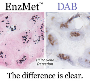 EnzMet vs DAB