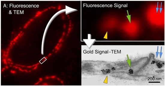 FNG [FluoroNanogold™] is a probe containing two different markers; it opens the possibility of imaging the same sample at both the optical and the EM level. Thus, it is easy to perform a multimodal investigation, either on different cells or on the same cell visualized by correlative microscopy.