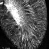 MicroCT of mouse kidney after iv injection of AuroVist 1.9nm gold nanoparticle xray contrast agent