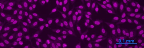 Fluorescent labeling of Alexa Fluor® 647 and Nanogold® - Fab' tertiary probe. The specimen is a slide from the NOVA Lite ANA HEp-2 test, an indirect immunofluorescent test system for the screening and semi-quantitative determination of anti-nuclear antibodies (ANA) in human serum (see ). The slide was stained using positive pattern control human sera, a Mouse anti-Human secondary antiboidy, and combined Alexa Fluor® 647 and Nanogold® - Fab' tertiary probe. Specimens were washed with PBS (30 minutes) between each step, then blocked by the addition of 7 % nonfat dried milk to the tertiary antibody solution (original magnification 400 X).