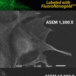 Fig. 1 Microtubules, visualized by optical microscopy (OM) and atmospheric scanning electron microscopy (ASEM: inverted SEM). COS7 cells were labeled with anti-alpha-tubulin primary antibody followed by Alexa Fluor 488 FluoroNanogold&trade; secondary antibody (Nanoprobes). Top: Fluorescence microscopy image. Middle: ASEM image of the same cells after gold enhancement by GoldEnhance&trade; EM (Nanoprobes). Botton: Higher magnification image of the right filopodia. Microtubule rails are clearly observed in the cytoplasm. (Sato et al., 2013)