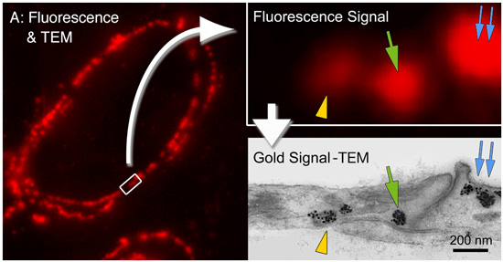 "FNG [FluoroNanogold™] is a probe containing two different markers; it opens the possibility of imaging the same sample at both the optical and the EM level. Thus, it is easy to perform a multimodal investigation, either on different cells or on the same cell visualized by correlative microscopy." Cheutin, T.; Sauvage, C.; Tchélidzé, P, O'Donohue, M. F.; Kaplan, H.; Beorchia, A., and Ploton, D.: Visualizing macromolecules with FluoroNanogold: from photon microscopy to electron tomography. Methods Cell Biol., 79, 559–574 (2007). [This is an entire chapter on FluoroNanogold, providing a detailed and well illustrated write-up of techniques for combined confocal fluorescence microscopic labeling and electron tomography.]
