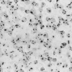 Single copies of HPV 16 in SiHa cells detected by CARD-amplified Nanogold®-silver ISH. This cell line derived from cervical carcinoma contains only one to a few copies of HPV 16, which appear as single spots. Cytospin preparation, counterstained with Nuclear Fast Red (light micrograph courtesy of Dr. G. Hacker, Landeskrankenstalten, Salzbrg. Austria).