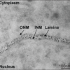 Halo-Nanogold targeting Lamin A/C at the nuclear membrane. “Live” cell TEM image after mouse embryo injection with Halo ligand-5 nm Nanogold. ONM=outer nuclear membrane, INM = inner nuclear membrane. Kindly provided by Dr. Alice Sherrard, Yale University.