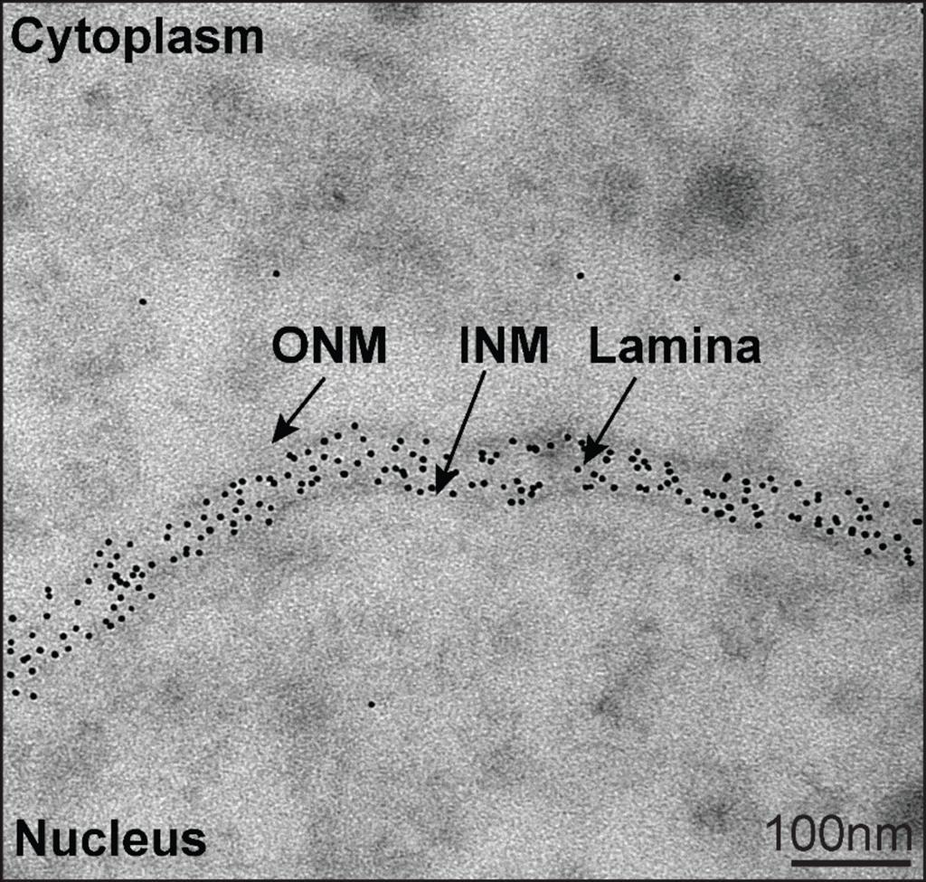 Halo-Nanogold targeting Lamin A/C at the nuclear membrane. “Live” cell TEM image after mouse embryo injection with Halo ligand-5 nm Nanogold. ONM=outer nuclear membrane, INM = inner nuclear membrane. Kindly provided by Dr. Alice Sherrard, Yale University.